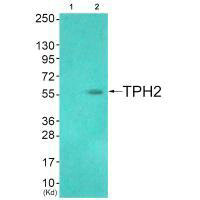 TPH2 (Ab-19) antibody