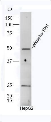 TPH (phospho-Ser260) antibody