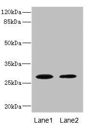 TPK1 antibody