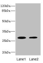 TPK1 Antibody