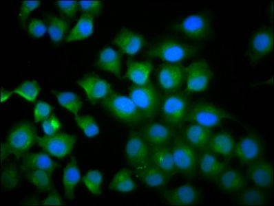 TPK1 Antibody
