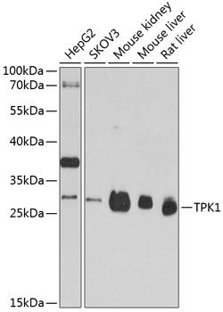 TPK1 antibody