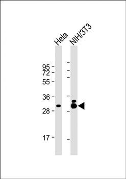 TPM3 antibody