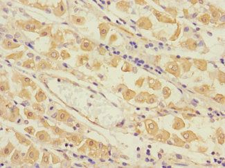 TPM4 antibody