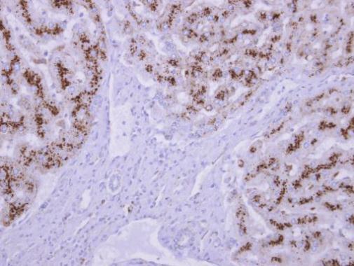 TPP1 antibody