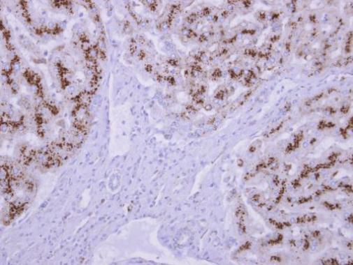 tripeptidyl peptidase 1 Antibody