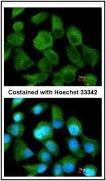 TPP1 antibody [N1C1]