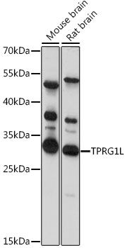 TPRG1L antibody