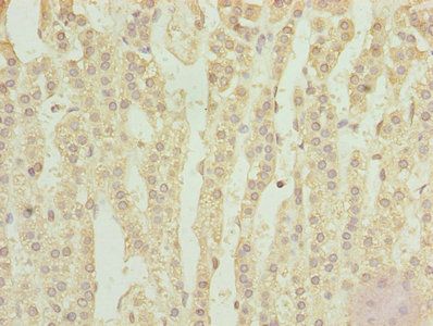 TPRKB Antibody