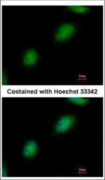 TP53RK binding protein Antibody