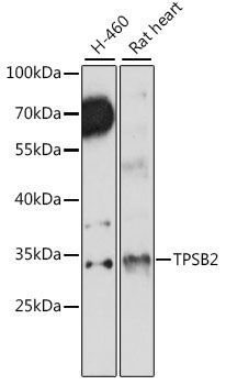 TPSB2 antibody