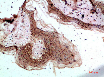 TPSD1 Antibody
