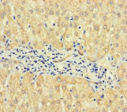 TPTE2 antibody