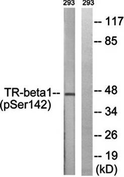 TR-beta1 (phospho-Ser142) antibody