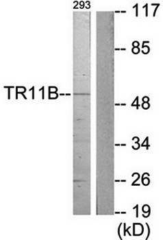 TR11B antibody