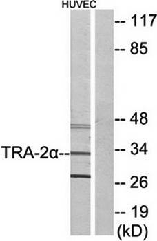 TRA-2alpha antibody
