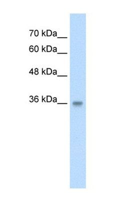 TRABD antibody