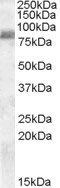 ZRANB1 antibody