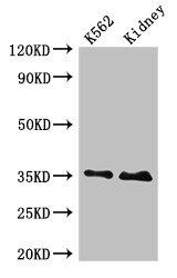 TRADD antibody