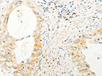 TRAF1 Antibody