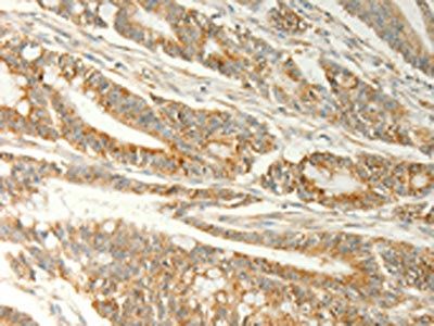 TRAF1 Antibody