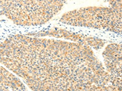 TRAF3IP2 Antibody