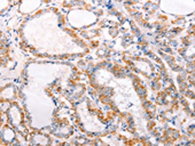 TRAF5 Antibody