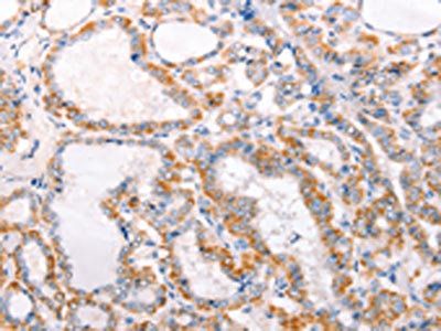 TRAF5 antibody