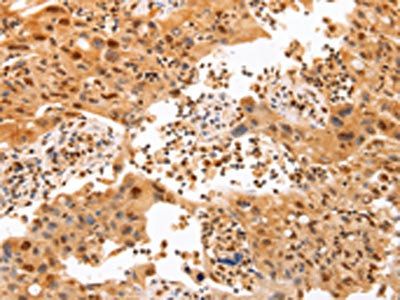 TRAF5 Antibody