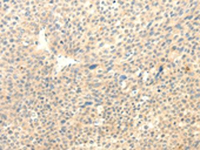 TRAF6 Antibody