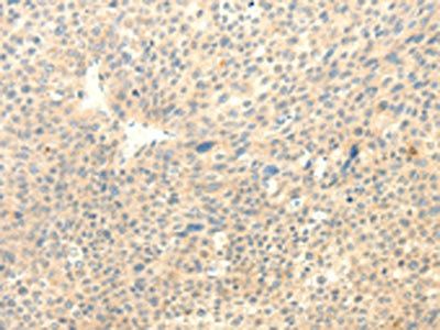 TRAF6 antibody