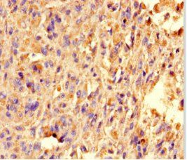 TRAK1 Antibody