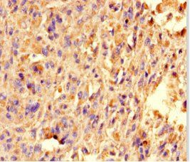 TRAK1 antibody