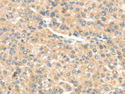 TRAK1 Antibody
