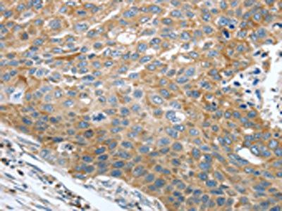TRAK1 Antibody
