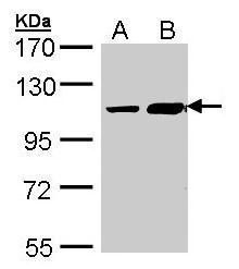 TRAK2 Rabbit Polyclonal Antibody
