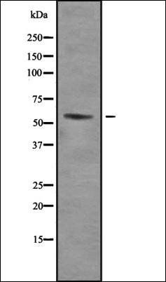 TRalpha antibody