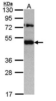 translocation associated membrane protein 1 antibody