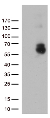Transaldolase 1 (TALDO1) antibody
