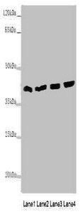 Transaldolase antibody