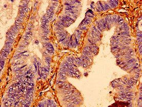 Transcription factor BTF3 antibody