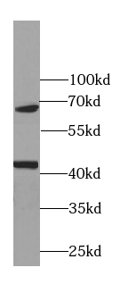 transcription termination factor-Specific antibody