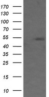 Transferrin Receptor 2 (TFR2) antibody
