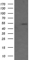 Transferrin Receptor 2 Antibody