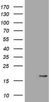 Transferrin Receptor 2 (TFR2) antibody