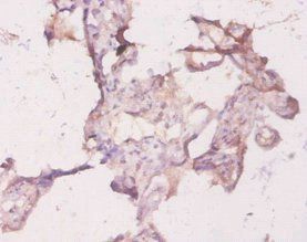 RHOA Antibody