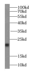 Transgelin 2 antibody