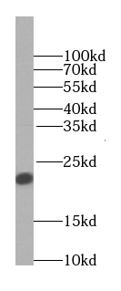Transgelin-2-specific antibody