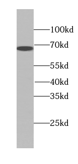 Transketolase antibody