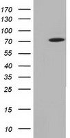 Transketolase (TKT) antibody